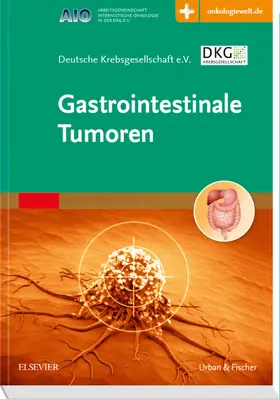  Gastrointestinale Tumoren - Mängelexemplar, kann leichte Gebrauchsspuren aufweisen. Sonderangebot ohne Rückgaberecht. Nur so lange der Vorrat reicht. | Buch |  Sack Fachmedien