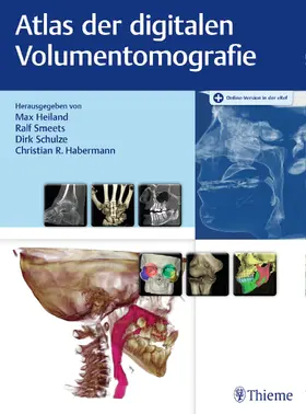 Heiland / Smeets / Schulze |  Digitale Volumentomografie - Mängelexemplar, kann leichte Gebrauchsspuren aufweisen. Sonderangebot ohne Rückgaberecht. Nur so lange der Vorrat reicht. | Buch |  Sack Fachmedien