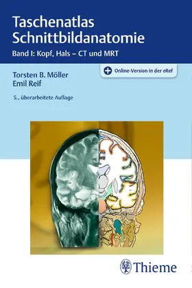 Möller / Reif |  Taschenatlas Schnittbildanatomie - Mängelexemplar, kann leichte Gebrauchsspuren aufweisen. Sonderangebot ohne Rückgaberecht. Nur so lange der Vorrat reicht. | Buch |  Sack Fachmedien