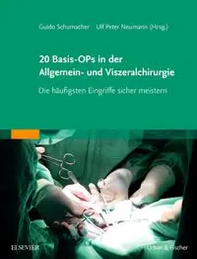 Schumacher / Neumann | 20 Basis-OPs in der Allgemein- und Viszeralchirurgie - Mängelexemplar, kann leichte Gebrauchsspuren aufweisen. Sonderangebot ohne Rückgaberecht. Nur so lange der Vorrat reicht. | Buch | 200-510601957-2 | sack.de