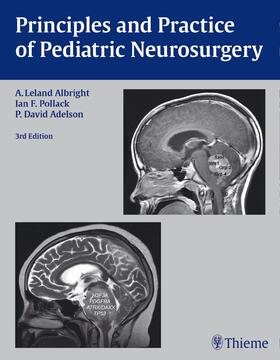 Albright / Pollack / Adelson |  Principles and Practice of Pediatric Neurosurgery | eBook | Sack Fachmedien