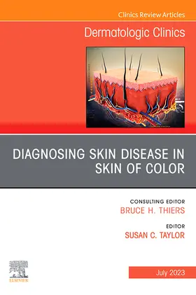 Consulting Editor: Bruce H. Thiers, MD |  Dermatologic Clinics | Zeitschrift |  Sack Fachmedien