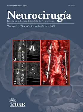  Neurocirugia | Zeitschrift |  Sack Fachmedien