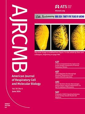  American Journal of Respiratory Cell and Molecular Biology (AJRCMB) | Zeitschrift |  Sack Fachmedien