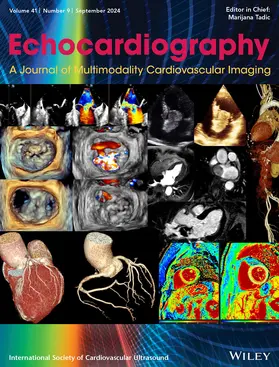  Echocardiography | Zeitschrift |  Sack Fachmedien