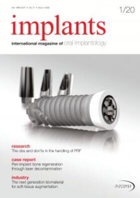  implants | Zeitschrift |  Sack Fachmedien