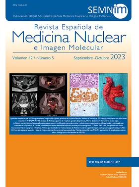  Revista Espanola de Medicina Nuclear e Imagen Molecular | Zeitschrift |  Sack Fachmedien