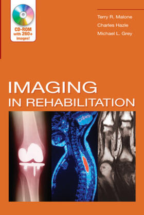 Malone / Hazle / Grey |  Imaging in Rehabilitation [With CDROM] | Buch |  Sack Fachmedien