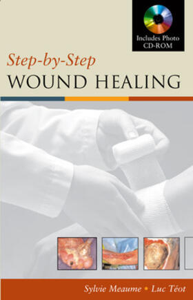 Meaume / Teot |  Step-By-Step Wound Healing | Buch |  Sack Fachmedien