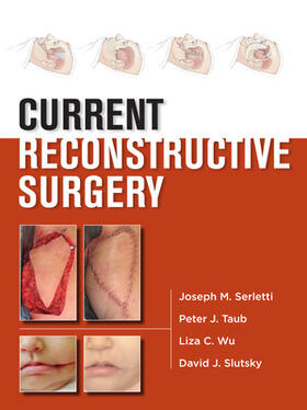 Serletti / Taub / Wu |  Current Reconstructive Surgery | Buch |  Sack Fachmedien
