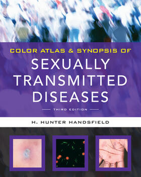 Handsfield |  Color Atlas & Synopsis of Sexually Transmitted Diseases | Buch |  Sack Fachmedien