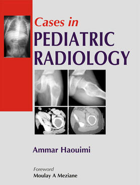 Haouimi |  Cases in Pediatric Radiology | Buch |  Sack Fachmedien