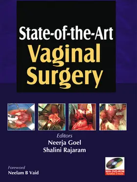 Goel |  State-Of-The-Art Vaginal Surgery | Buch |  Sack Fachmedien