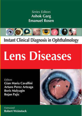 Cavallini / Arteaga / Malyugin |  Lens Diseases | Buch |  Sack Fachmedien