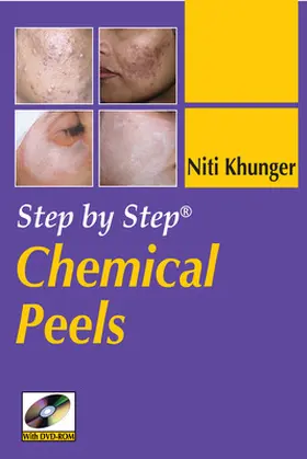 Khunger |  Step by Step Chemical Peels | Sonstiges |  Sack Fachmedien