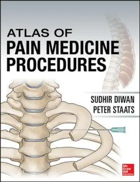 Diwan / Staats |  Atlas of Pain Medicine Procedures | Buch |  Sack Fachmedien