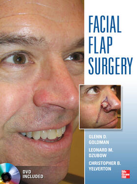 Goldman / Dzubow / Yelverton |  Facial Flaps Surgery | Sonstiges |  Sack Fachmedien