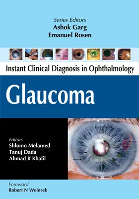 Melamed / Dada / Khalil |  Glaucoma | Buch |  Sack Fachmedien