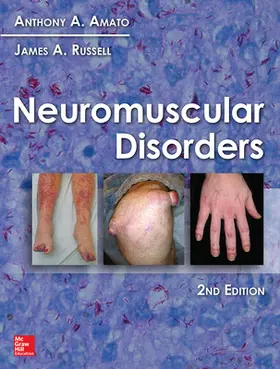 Amato / Russell |  Neuromuscular Disorders, 2nd Edition | Buch |  Sack Fachmedien