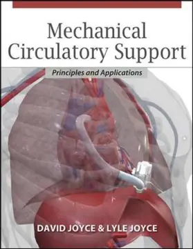 Joyce / Locke | Mechanical Circulatory Support: Principles and Applications | Buch | 978-0-07-175344-9 | sack.de