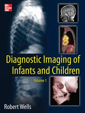 Wells |  Diagnostic Imaging of Infants and Children | Buch |  Sack Fachmedien