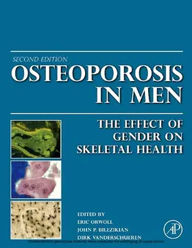 Orwoll / Bilezikian / Vanderschueren |  Osteoporosis in Men | eBook | Sack Fachmedien