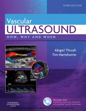 Thrush BSc(Physics) / Thrush / Hartshorne HND in Biology |  Vascular Ultrasound | eBook | Sack Fachmedien