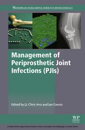 Arts / Geurts |  Management of Periprosthetic Joint Infections (PJIs) | eBook | Sack Fachmedien