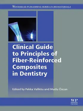 Vallittu / ™zcan |  Clinical Guide to Principles of Fiber-Reinforced Composites in Dentistry | eBook | Sack Fachmedien