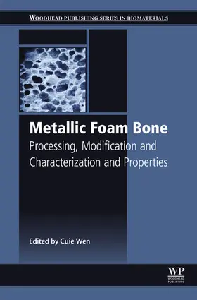 Wen |  Metallic Foam Bone | eBook | Sack Fachmedien