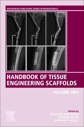 Mozafari / Sefat / Atala |  Handbook of Tissue Engineering Scaffolds: Volume Two | Buch |  Sack Fachmedien