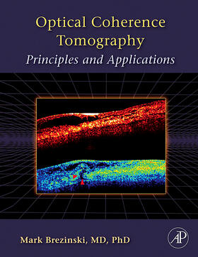 Brezinski |  Optical Coherence Tomography | Buch |  Sack Fachmedien