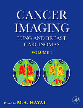 Hayat |  Cancer Imaging | Buch |  Sack Fachmedien