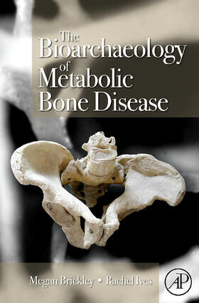 Brickley / Ives |  The Bioarchaeology of Metabolic Bone Disease | Buch |  Sack Fachmedien