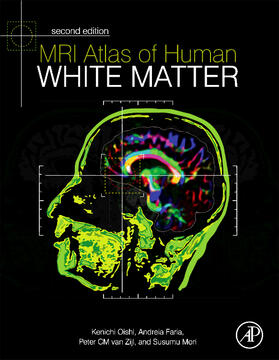 Oishi / Faria / van Zijl |  MRI Atlas of Human White Matter | Buch |  Sack Fachmedien