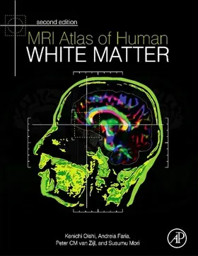 Oishi / Faria / Zijl |  MRI Atlas of Human White Matter | eBook | Sack Fachmedien