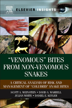 Weinstein / Warrell / White |  "venomous" Bites from Non-Venomous Snakes: A Critical Analysis of Risk and Management of "colubrid" Snake Bites | Buch |  Sack Fachmedien