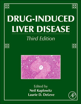 Kaplowitz / DeLeve |  Drug-Induced Liver Disease | Buch |  Sack Fachmedien