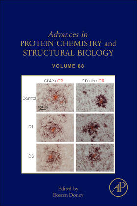  Inflammation in Neuropsychiatric Disorders | Buch |  Sack Fachmedien