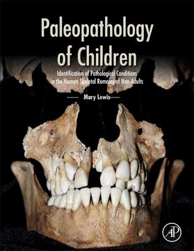 Lewis |  Paleopathology of Children | Buch |  Sack Fachmedien