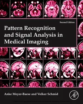 Meyer-Baese / Schmid |  Pattern Recognition and Signal Analysis in Medical Imaging | eBook | Sack Fachmedien