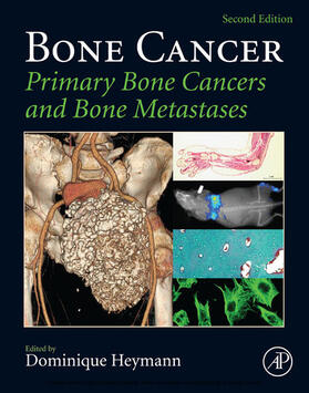 Heymann |  Bone Cancer | eBook | Sack Fachmedien