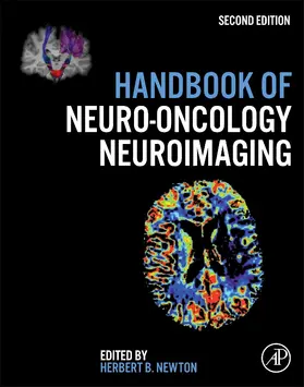 Newton |  Handbook of Neuro-Oncology Neuroimaging | Buch |  Sack Fachmedien