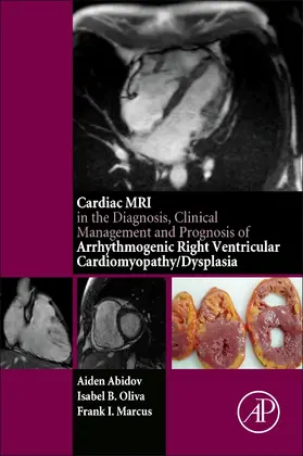 Abidov / Oliva |  Cardiac MRI in Diagnosis, Clinical Management, and Prognosis of Arrhythmogenic Right Ventricular Cardiomyopathy/Dysplasia | Buch |  Sack Fachmedien