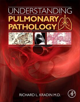 Kradin |  Understanding Pulmonary Pathology | Buch |  Sack Fachmedien