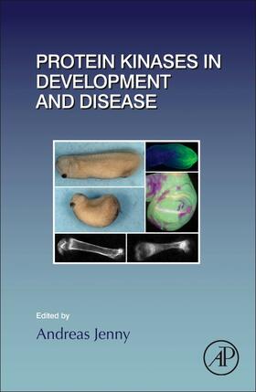 Jenny |  Protein Kinases in Development and Disease | Buch |  Sack Fachmedien