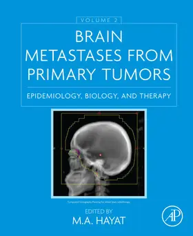 Hayat |  Brain Metastases from Primary Tumors, Volume 2 | eBook | Sack Fachmedien