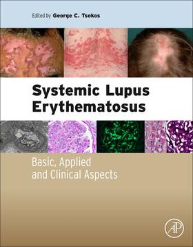 Tsokos |  Systemic Lupus Erythematosus | Buch |  Sack Fachmedien