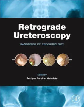  Retrograde Ureteroscopy | Buch |  Sack Fachmedien