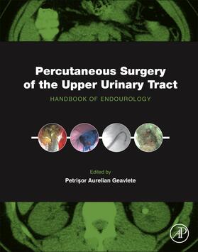 Geavlete |  Percutaneous Surgery of the Upper Urinary Tract | Buch |  Sack Fachmedien